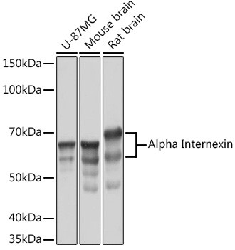 alpha Internexin Antibody in Western Blot (WB)