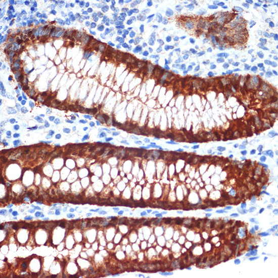 Galectin 4 Antibody in Immunohistochemistry (Paraffin) (IHC (P))