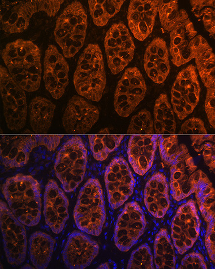 Galectin 4 Antibody in Immunohistochemistry (Paraffin) (IHC (P))