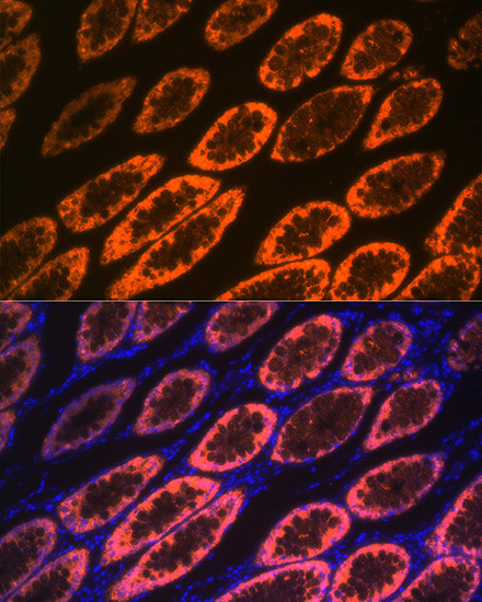 Galectin 4 Antibody in Immunohistochemistry (Paraffin) (IHC (P))