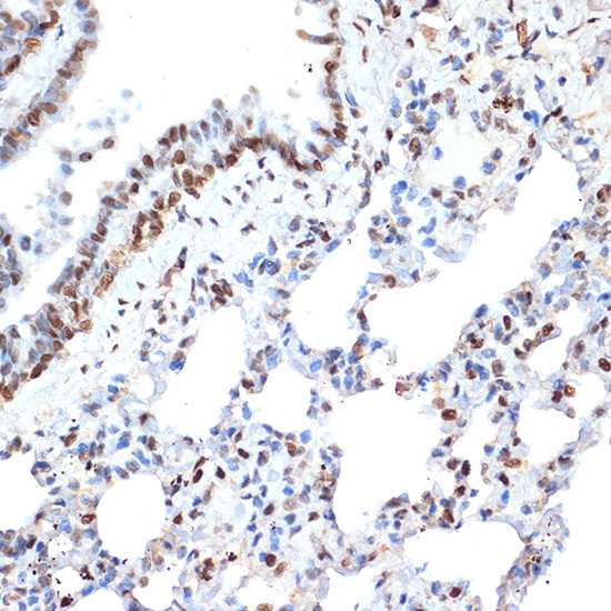 Histone H2A Antibody in Immunohistochemistry (Paraffin) (IHC (P))