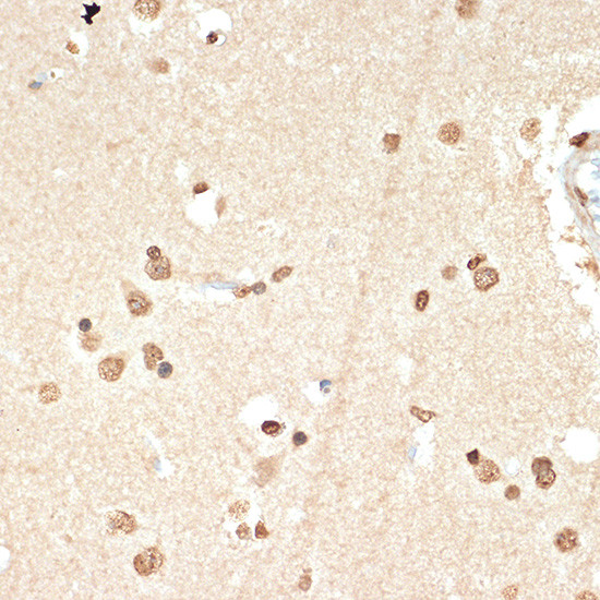 Histone H2A Antibody in Immunohistochemistry (Paraffin) (IHC (P))