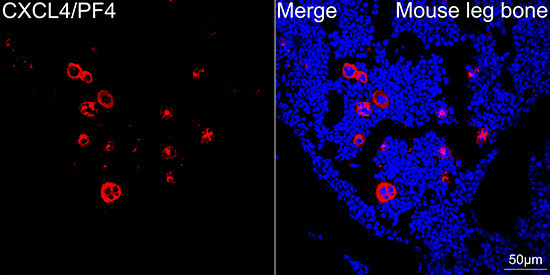 PF4 Antibody in Immunocytochemistry (ICC/IF)