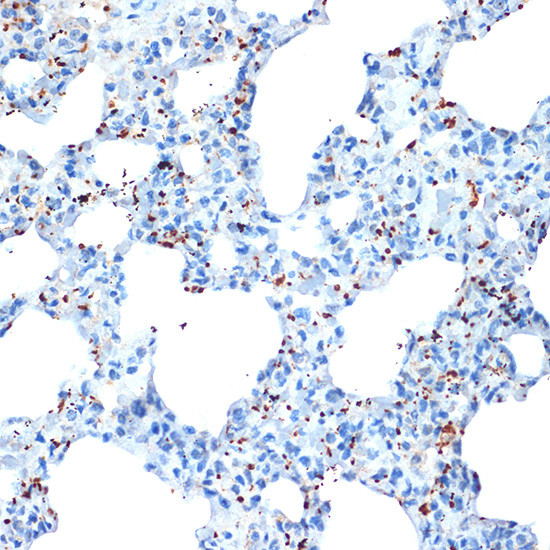 PF4 Antibody in Immunohistochemistry (Paraffin) (IHC (P))