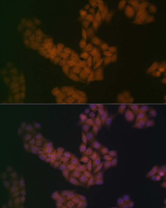 BANF1 Antibody in Immunocytochemistry (ICC/IF)