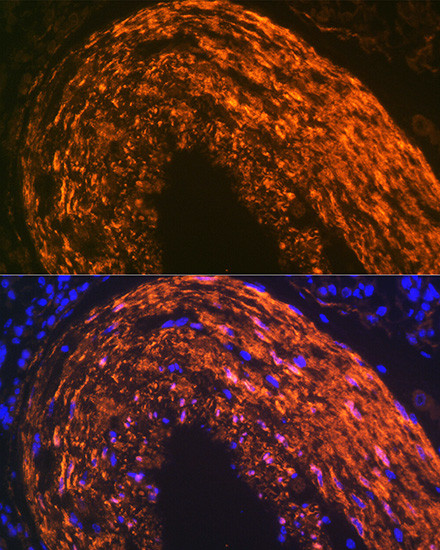 Calponin 1 Antibody in Immunohistochemistry (Paraffin) (IHC (P))