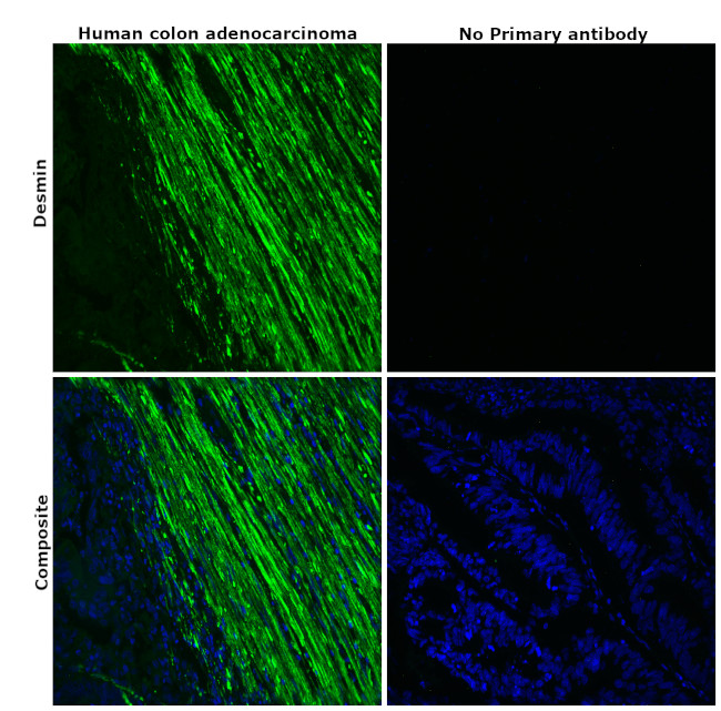 Desmin Antibody in Immunohistochemistry (Paraffin) (IHC (P))