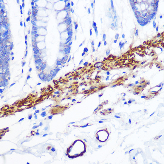 Desmin Antibody in Immunohistochemistry (Paraffin) (IHC (P))