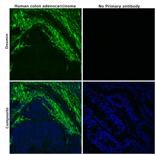 Desmin Antibody in Immunohistochemistry (Paraffin) (IHC (P))