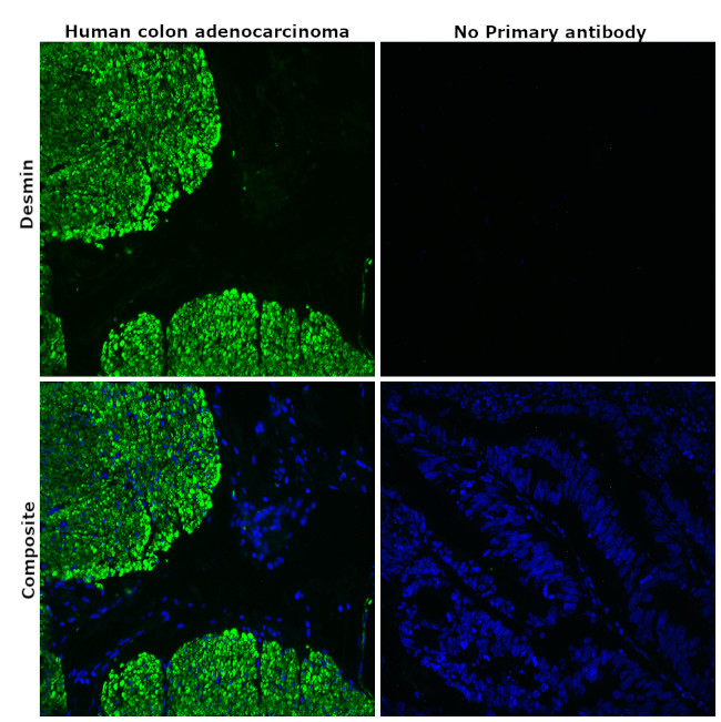 Desmin Antibody in Immunohistochemistry (Paraffin) (IHC (P))