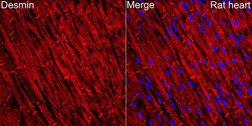 Desmin Antibody in Immunohistochemistry (Paraffin) (IHC (P))