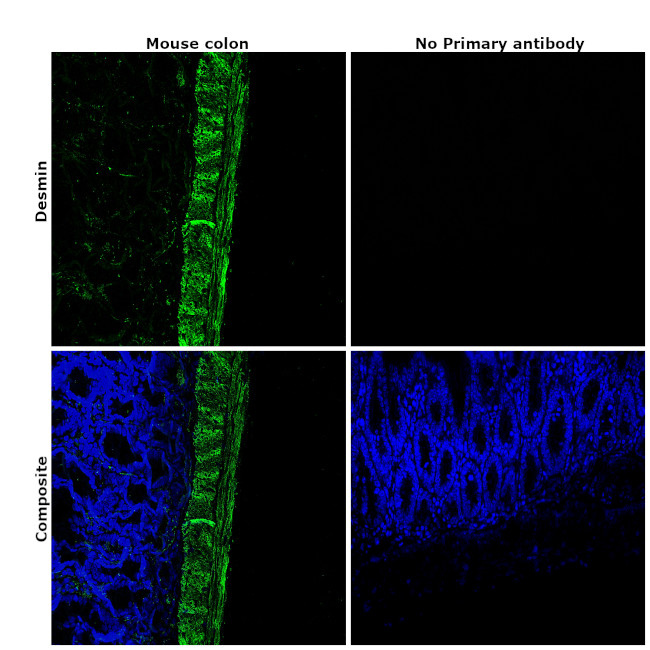 Desmin Antibody in Immunohistochemistry (Paraffin) (IHC (P))