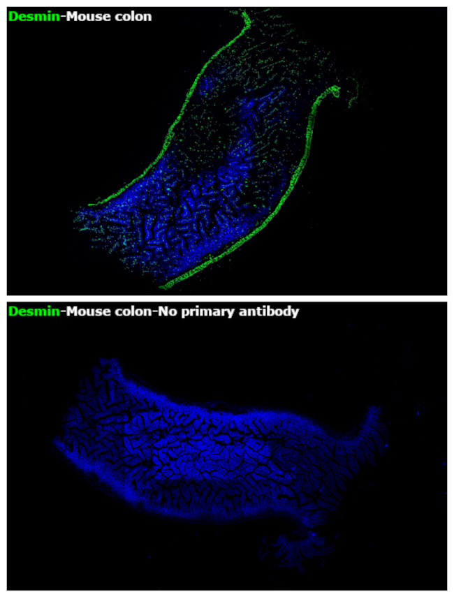 Desmin Antibody in Immunohistochemistry (Paraffin) (IHC (P))