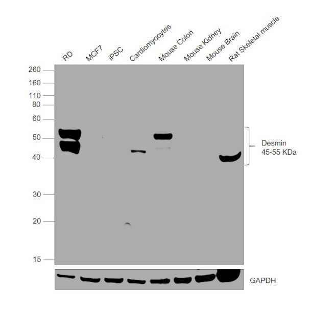 Desmin Antibody in Western Blot (WB)