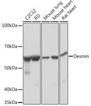 Desmin Antibody in Western Blot (WB)