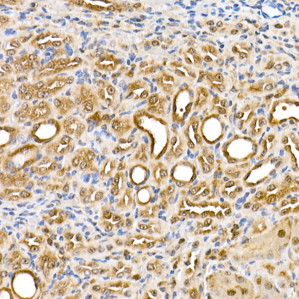 Thioredoxin 1 Antibody in Immunohistochemistry (Paraffin) (IHC (P))