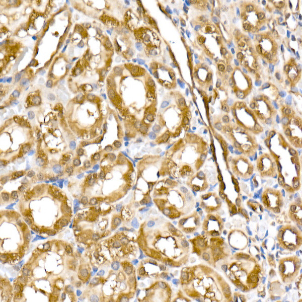 Thioredoxin 1 Antibody in Immunohistochemistry (Paraffin) (IHC (P))