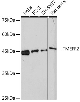 TMEFF2 Antibody in Western Blot (WB)