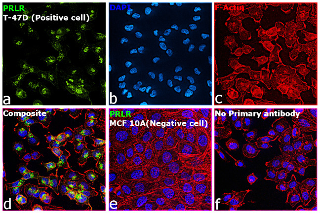 Prolactin Receptor Antibody