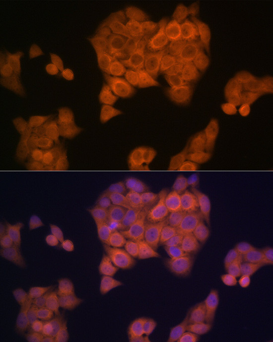 PMP70 Antibody in Immunocytochemistry (ICC/IF)