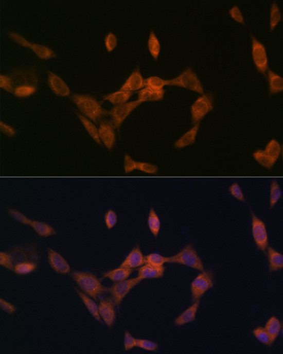 PMP70 Antibody in Immunocytochemistry (ICC/IF)