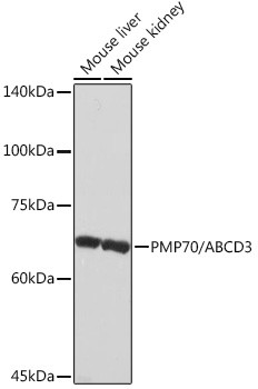 PMP70 Antibody in Western Blot (WB)