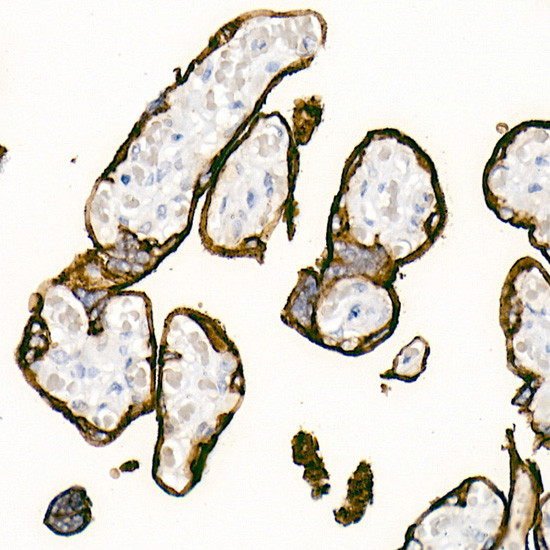 Placental Alkaline Phosphatase Antibody in Immunohistochemistry (Paraffin) (IHC (P))