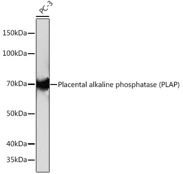 Placental Alkaline Phosphatase Antibody in Western Blot (WB)