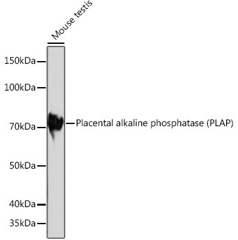 Placental Alkaline Phosphatase Antibody in Western Blot (WB)