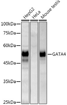 GATA4 Antibody in Western Blot (WB)