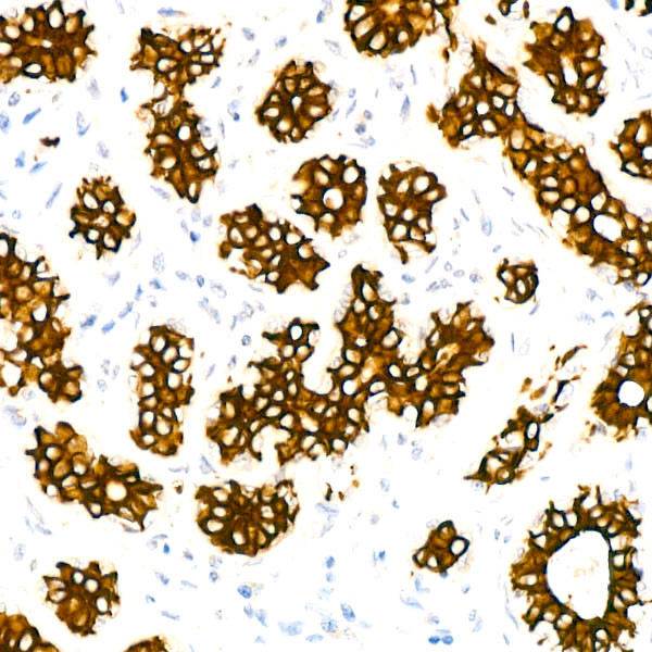 Cytokeratin 7 Antibody in Immunohistochemistry (Paraffin) (IHC (P))