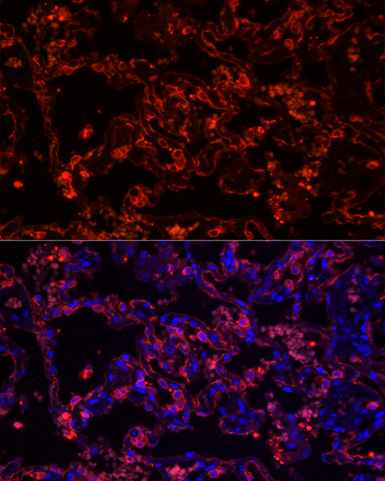 Cytokeratin 7 Antibody in Immunohistochemistry (Paraffin) (IHC (P))