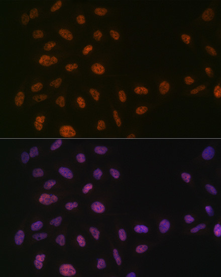 PRP8 Antibody in Immunocytochemistry (ICC/IF)