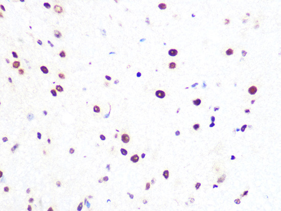 PRP8 Antibody in Immunohistochemistry (Paraffin) (IHC (P))