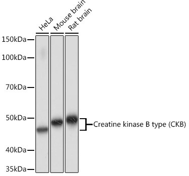 Creatine Kinase BB Antibody in Western Blot (WB)