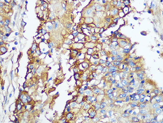 Carbonic Anhydrase IX Antibody in Immunohistochemistry (Paraffin) (IHC (P))