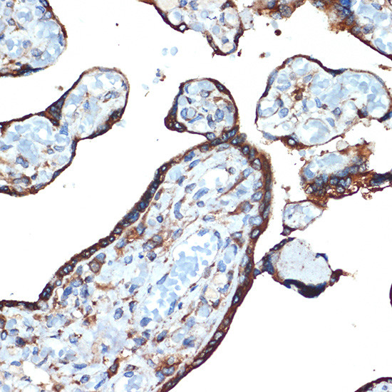 LMAN1 Antibody in Immunohistochemistry (Paraffin) (IHC (P))