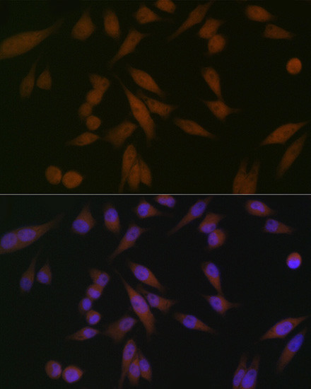 PAR4 Antibody in Immunocytochemistry (ICC/IF)