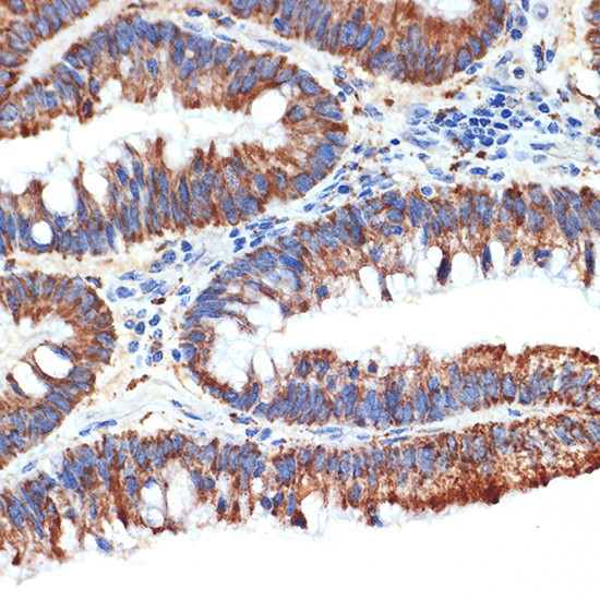 PAR4 Antibody in Immunohistochemistry (Paraffin) (IHC (P))