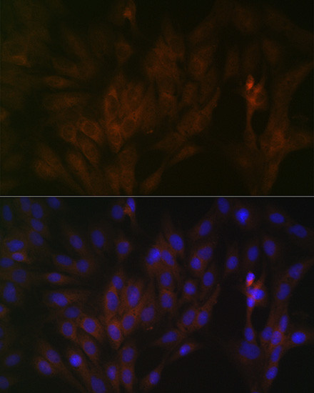 15-PGDH Antibody in Immunocytochemistry (ICC/IF)