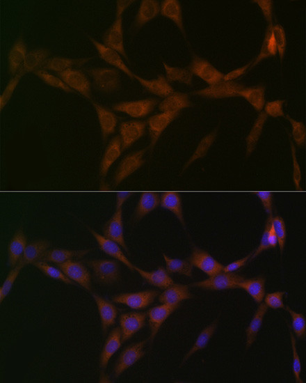 15-PGDH Antibody in Immunocytochemistry (ICC/IF)