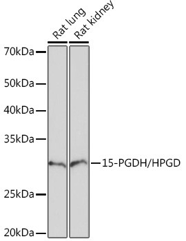 15-PGDH Antibody in Western Blot (WB)