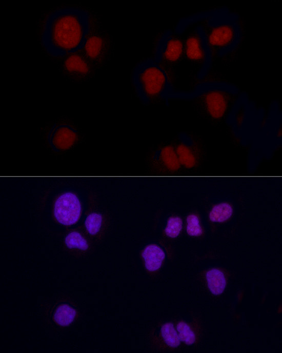 Brachyury Antibody in Immunocytochemistry (ICC/IF)