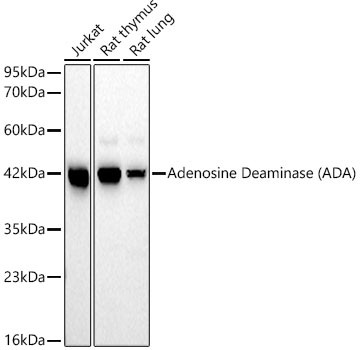 Adenosine Deaminase Antibody in Western Blot (WB)