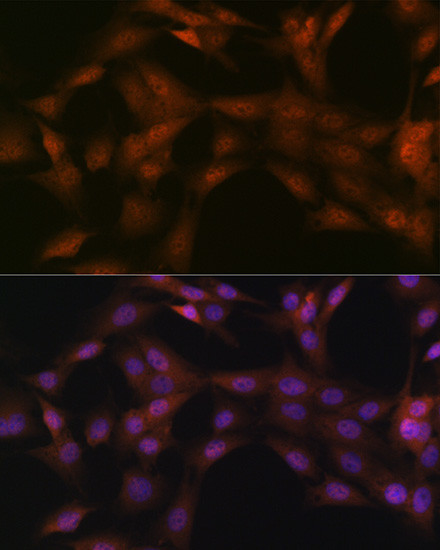 p23 Antibody in Immunocytochemistry (ICC/IF)