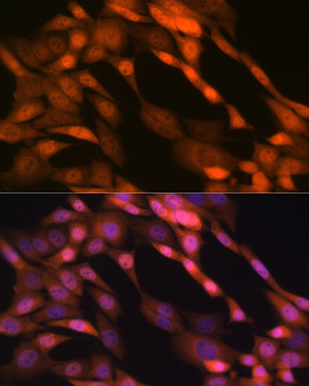 p23 Antibody in Immunocytochemistry (ICC/IF)