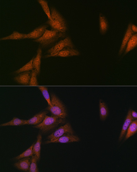 p23 Antibody in Immunocytochemistry (ICC/IF)