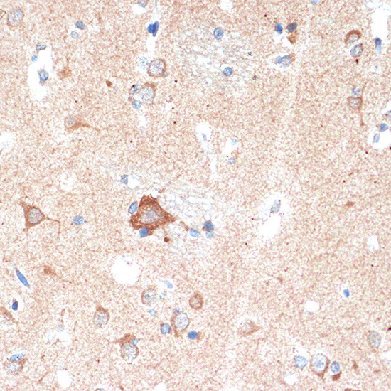 ADORA1 Antibody in Immunohistochemistry (Paraffin) (IHC (P))