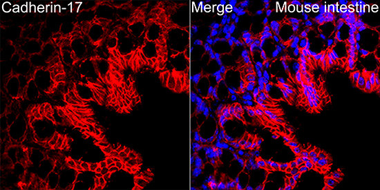 CDH17 Antibody in Immunohistochemistry (Paraffin) (IHC (P))