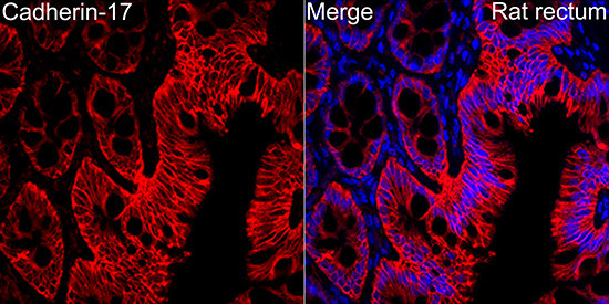 CDH17 Antibody in Immunohistochemistry (Paraffin) (IHC (P))